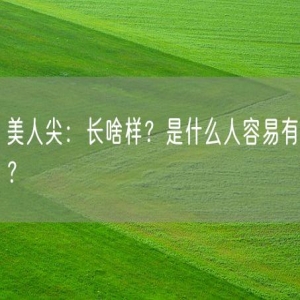 美人尖:长啥样?是什么人容易有?
